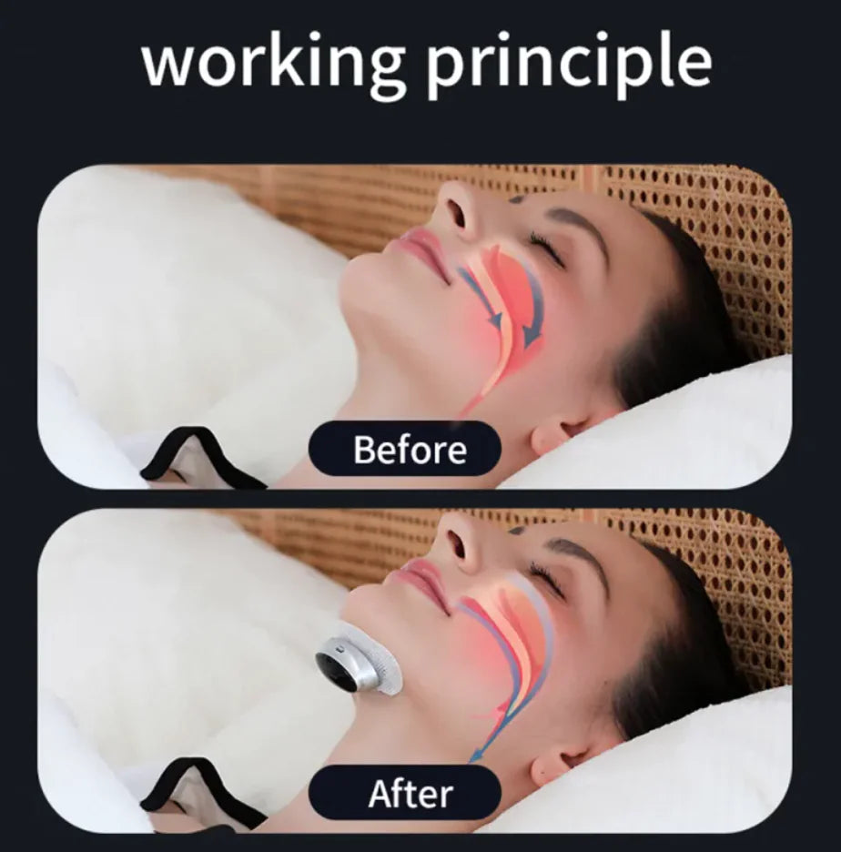Smart Anti-Snoring Throat Patch