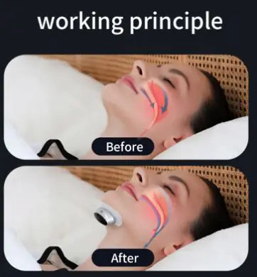 Smart Throat Pulse Anti Snoring Device